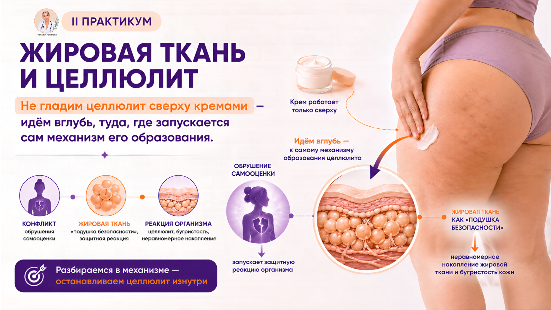 Жировая ткань и целлюлит
